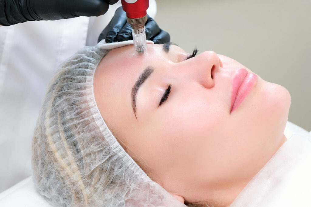 Skin Suite RX Microneedling